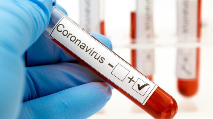 Esistono farmaci o vaccini per combattere il Coronavirus?