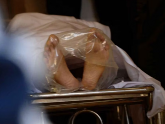 cadaveri grasso estetica