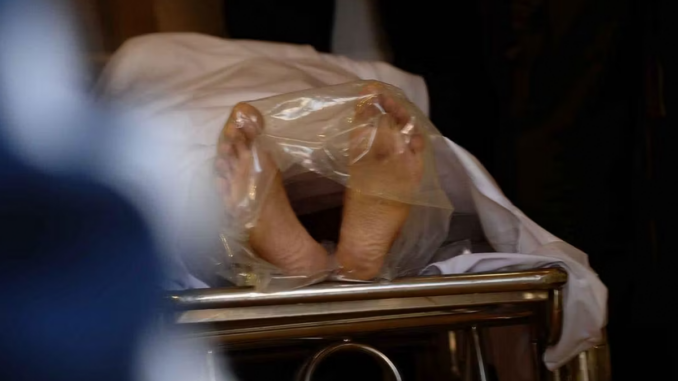 cadaveri grasso estetica